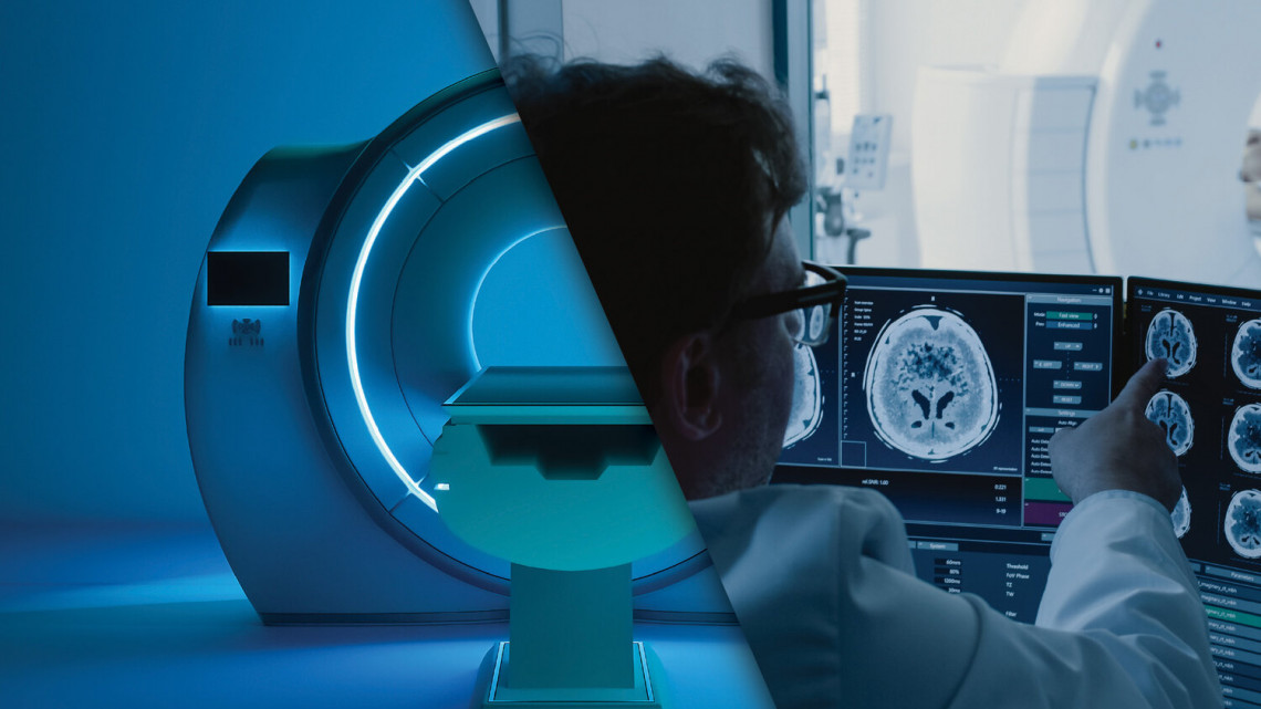 Natív MR vizsgálat 1 választható régióra.