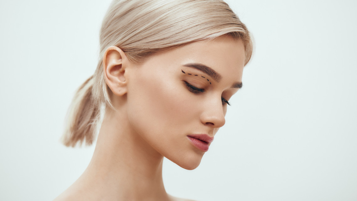 Műtét nélküli lézeres szemhéjlifting és szemkörnyék fiatalítás!